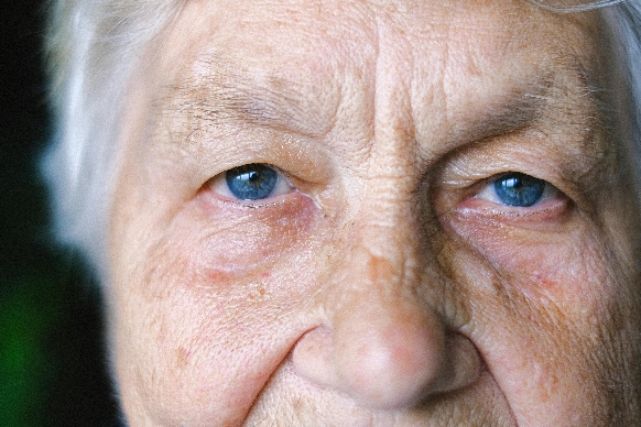 dementia, help yourself deal with it